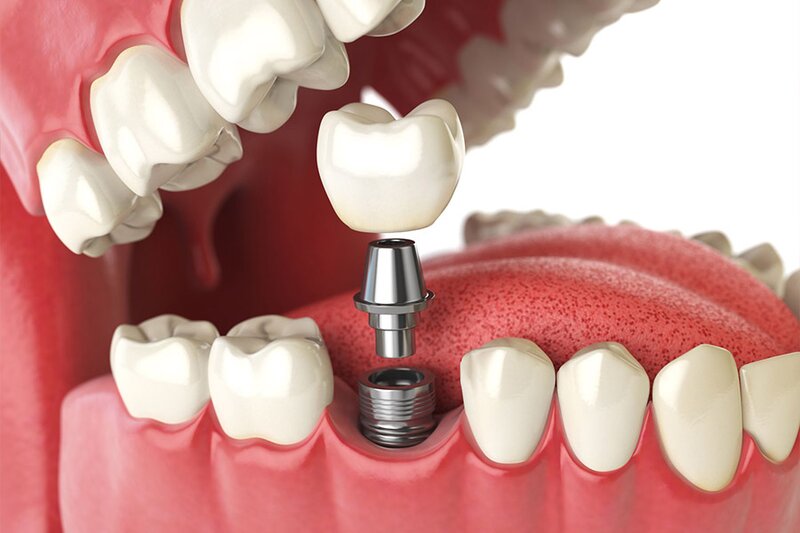 Catalin Dumitru Dental - Clinici stomatologice